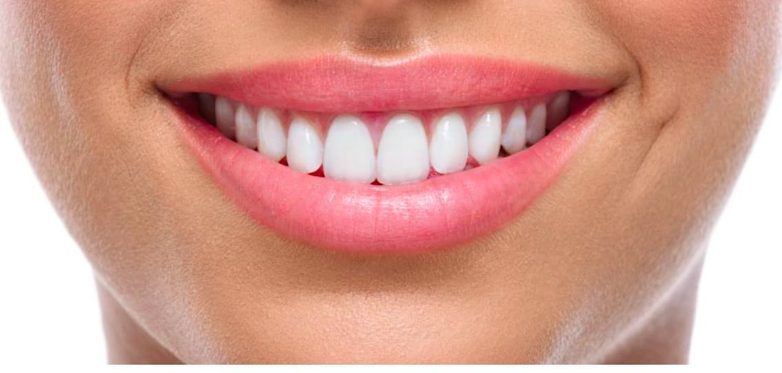A patient's smile after treatment at Vetri Dental Clinic